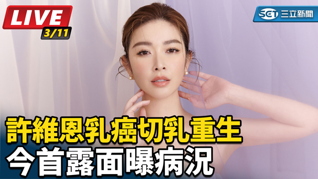 許維恩乳癌切乳重生　今首露面曝病況