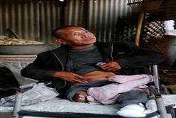 河北農民沒錢治病 自己鋸斷右腿