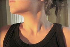 Google申請電子刺青專利