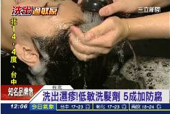 洗髮害濕疹1200