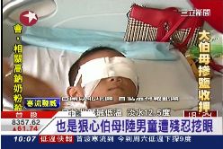 挖眼恐翻案(舊帶) 再修標