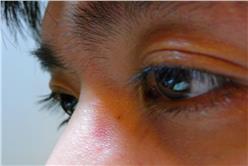 眼睛(flickr／Chung Shao Tung)