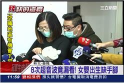 缺四肢,女嬰,產檢,超音波,醫療疏失,沒手腳