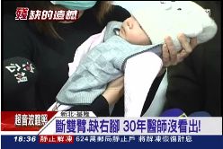 F女嬰缺手腳1800