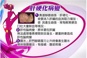 B肝、C肝惡化　恐成肝硬化