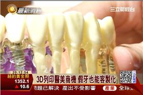 3D,列印,明碁,印表機,醫美,齒模,三緯,假牙