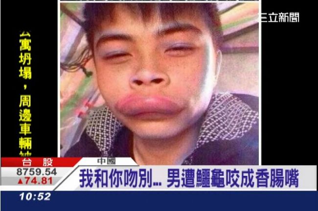 和龜頭的親密接觸…男子被咬到腫起來