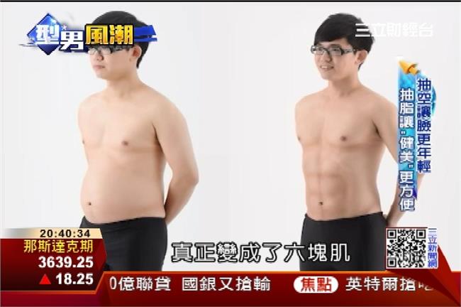 想當型男別嫌麻煩　男生除皺整形正夯