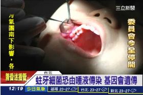 蛀牙都爸媽g1200