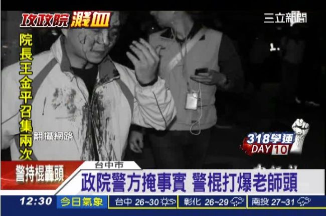 血腥暴力現形！老師遭警棍爆頭逢五針