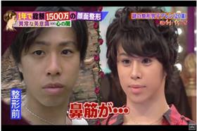 0328_日本整形男