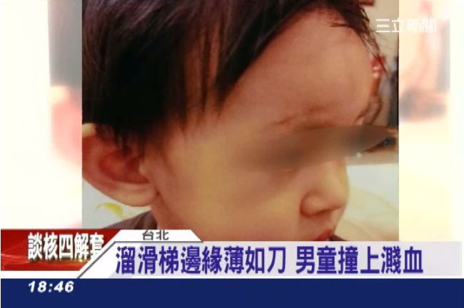 速食店溜滑梯薄如刀　男童撞上濺血