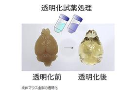 日本研發特殊溶液　讓「腦部透明化」