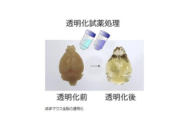 日本研發特殊溶液　讓「腦部透明化」