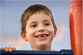 牙齒牙刷-flickr-Peter Dedina