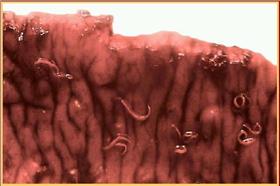 鉤蟲(大陸網站)