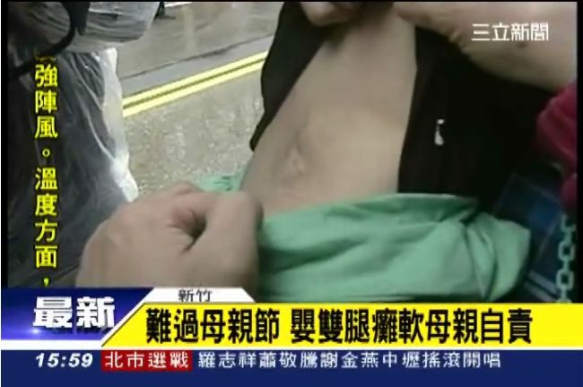 自費產檢嬰脊柱裂　家屬「路過」抗議
