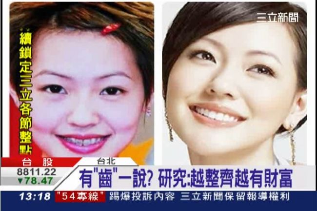有影嘸？英研究：牙越整齊越有財富！