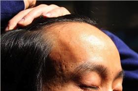 全球调查：哪國男人禿得最厲害－煎蛋