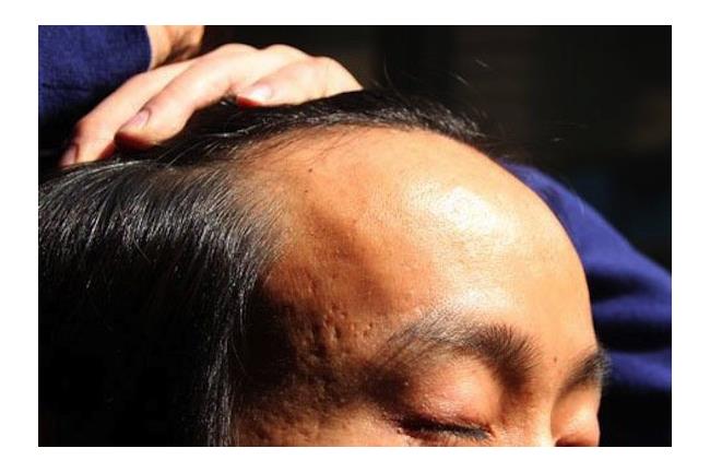 「頂上」危機！哪國男人禿得最厲害？