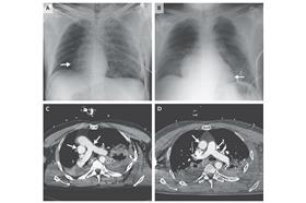 X光心臟-livescience.com