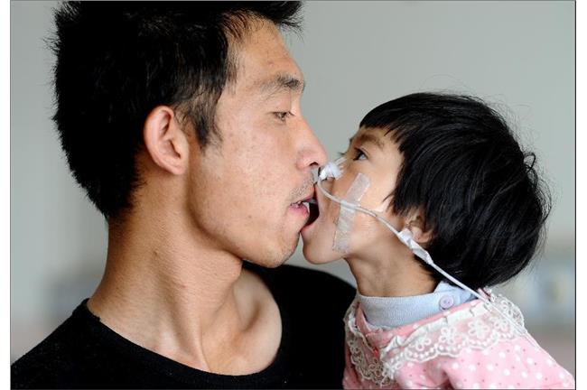 嘴對嘴　餵食爸爸：救救我的女兒