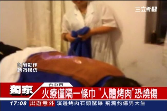 獨／火療效果好？「人體烤肉」恐燒傷