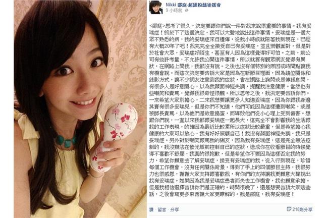 勇敢的宅男女神！邵庭承認罹患妥瑞症