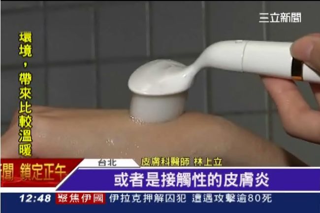 女狂用洗臉機清洗　皮膚紅腫滲組織液