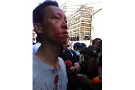 行天宮爆頭男子　來源：蘋果臉書