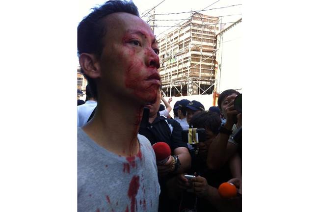 再爆衝突！嗆張志軍　男子遭噴燈爆頭