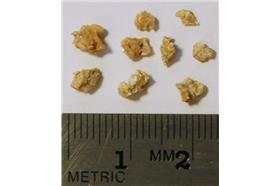 腎結石-維基百科-RJHall