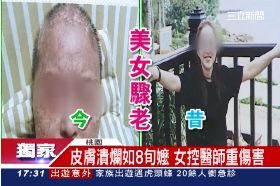 f移骨髓超老1700