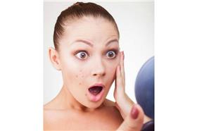 (名家)痘痘_卡卡洛普