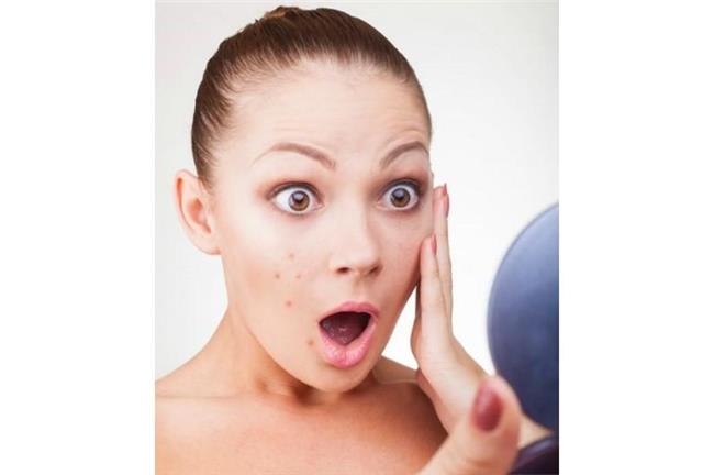 讓人抓狂的五大「長痘痘」部位是…？
