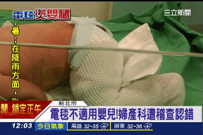 電毯燙女嬰　業者：熱敷墊禁嬰兒使用