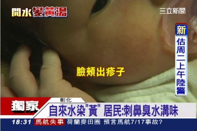 地方的自來水如泥巴！髒到臉上都長疹