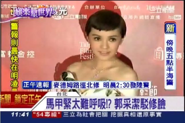 女星腫麼長得不一樣？郭采潔疑整形