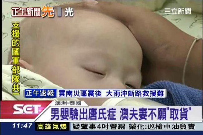 代理孕母懷唐氏兒　父母竟遺棄不扶養