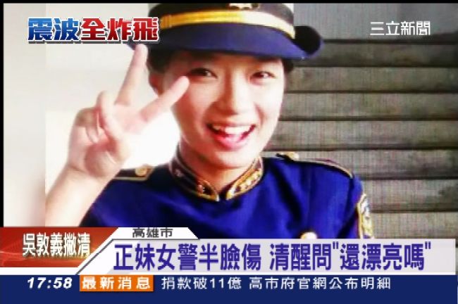 正妹女警半臉傷　清醒問臉蛋母揪心痛