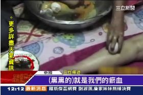 黑心蛋療團1200