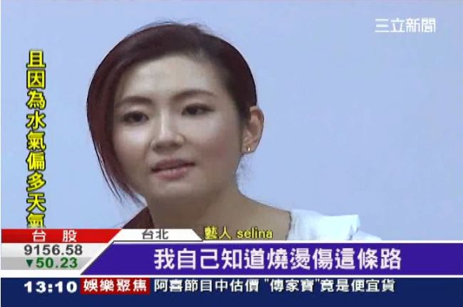 陳小妹加油！Selina鼓勵燒傷者