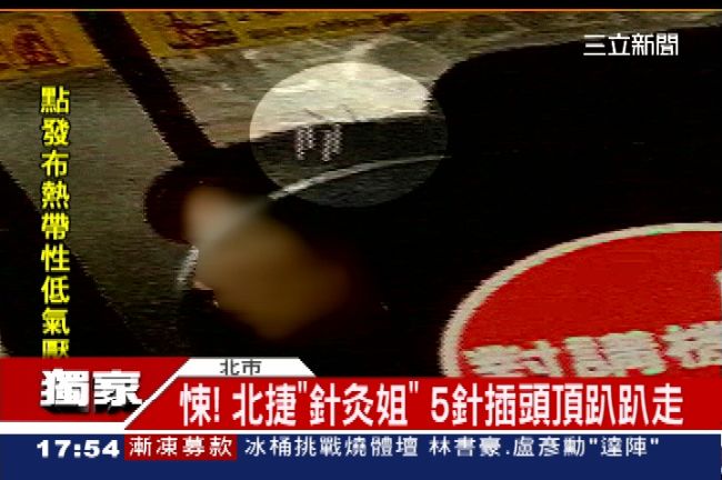 北捷現「針灸姐」　5針插頭頂趴趴走