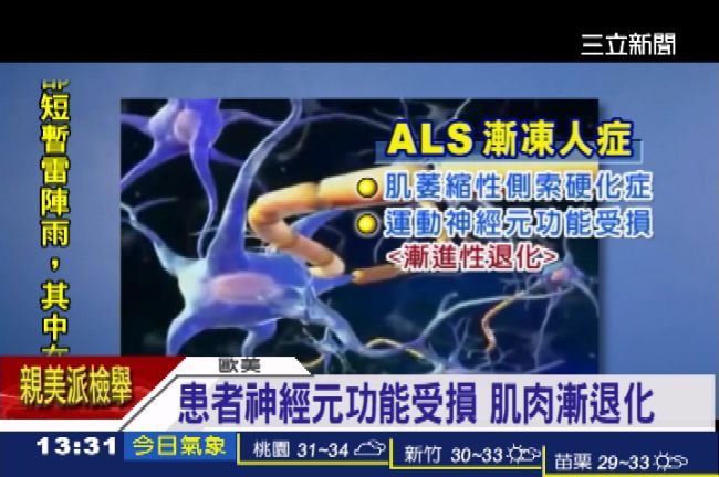 五大絕症之一　漸凍症至今查無病因