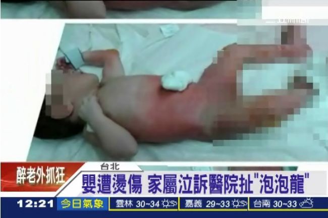嬰遭燙傷　家屬泣訴醫院扯「泡泡龍」
