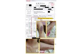 金賢重女友瘀青照/翻攝自Dispatch