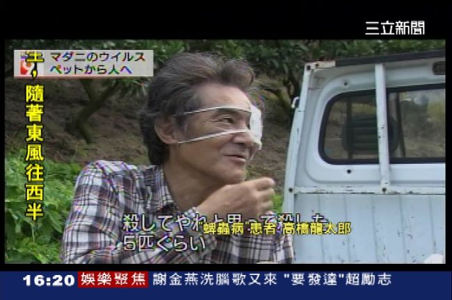捏死蝨子染「蜱蟲病」　日男左眼失明