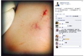 陳妍希,受傷,柯震東(陳妍希臉書)