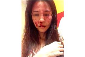 小劉亦菲家暴_微博