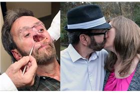 癌症,深吻(每日郵報)